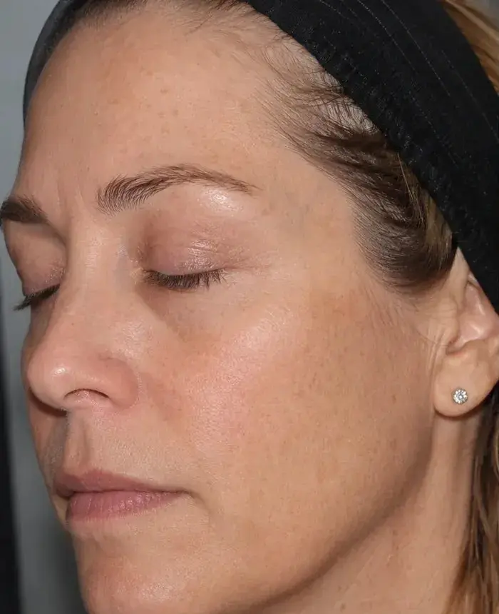 Tone & texture refresh before